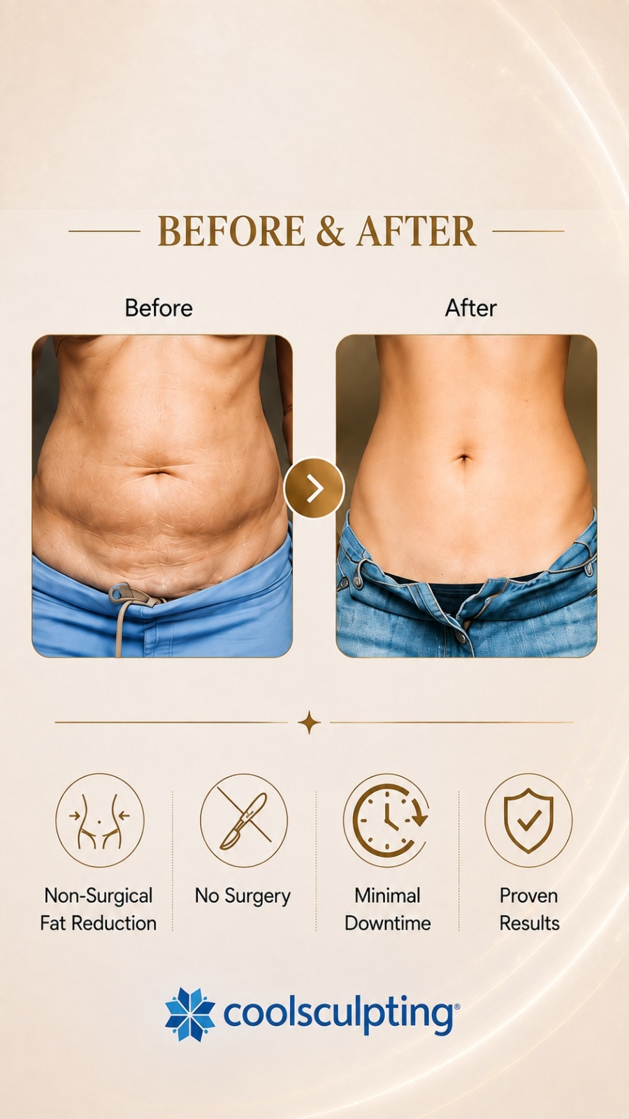 Supplied CoolSculpting before-and-after result